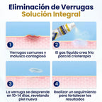 Timilk® ChillErase - Spray quita verrugas