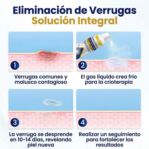 Timilk® ChillErase - Spray quita verrugas