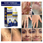 Timilk® ChillErase - Spray quita verrugas