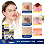 Timilk® ChillErase - Spray quita verrugas